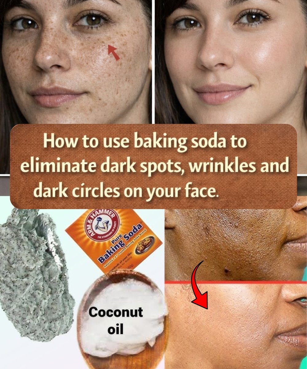 Baking Soda Face Mask: Natural Way to Smooth and Brighten Your Skin