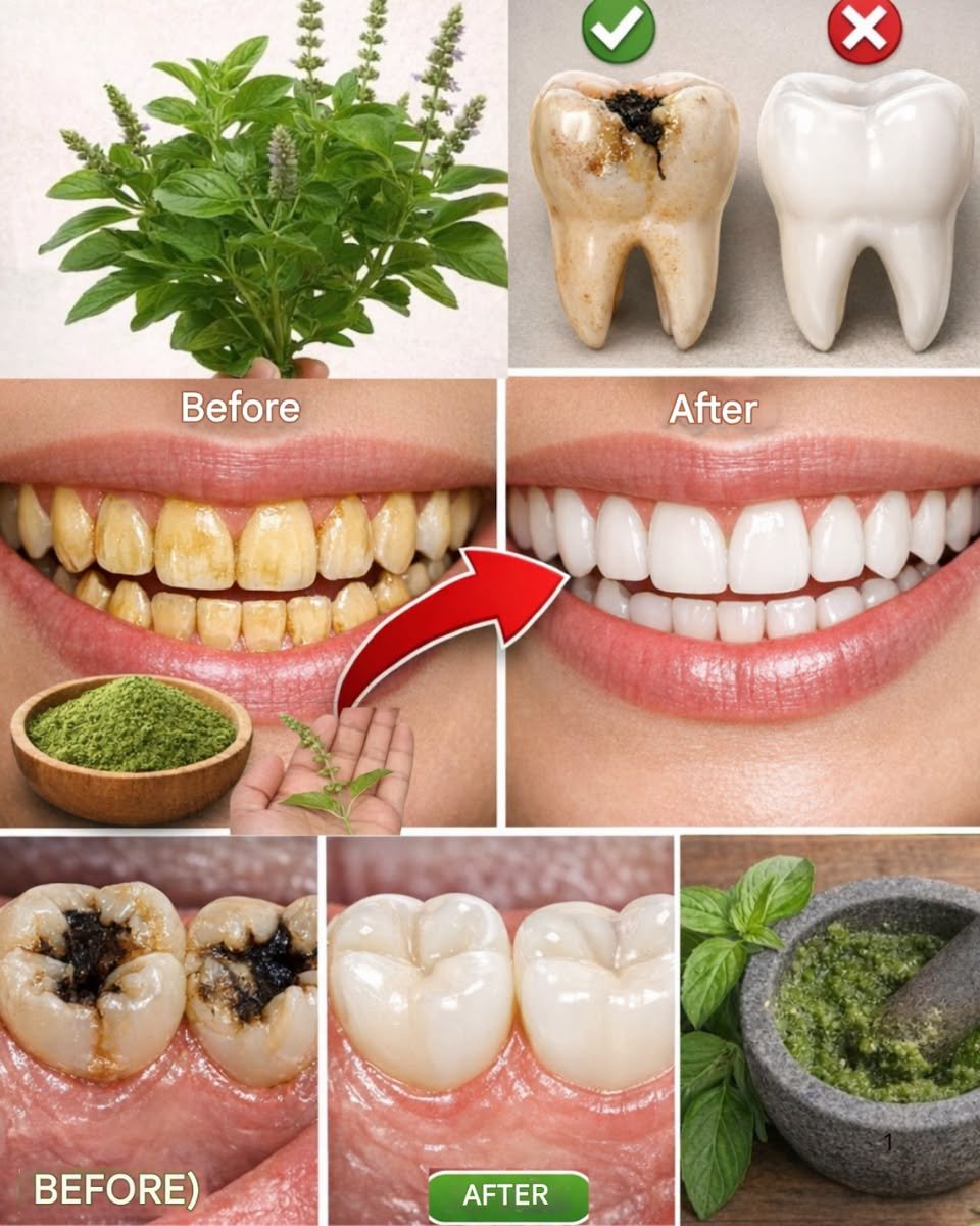 🌿 How Holy Basil (Tulsi) May Support Your Oral Health Naturally