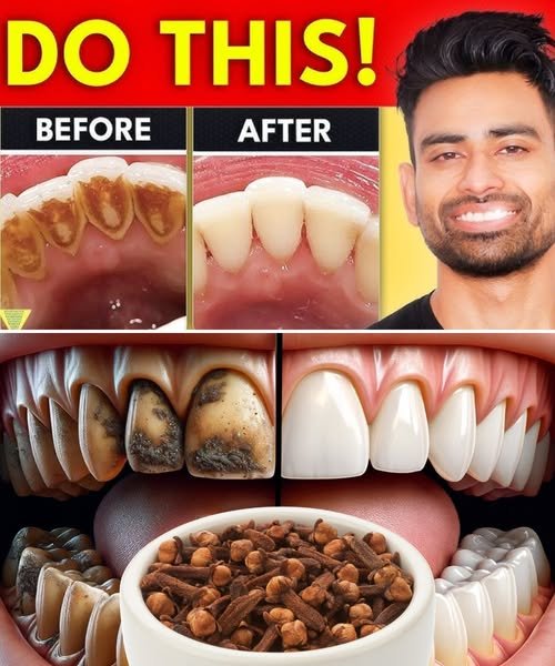 Say Goodbye to Expensive Dental Visits with These 9 Natural Remedies 🦷✨