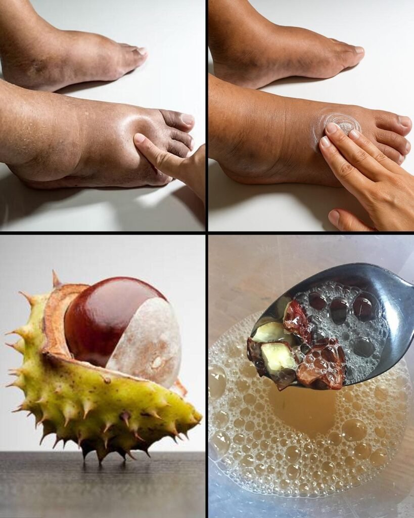 Horse Chestnut: The Strongest Natural Remedy for Swollen Legs and More…