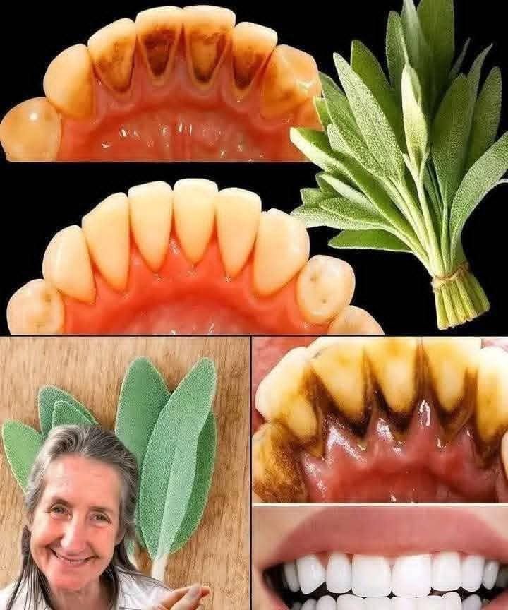 Remove Tartar and Whiten Your Teeth Naturally with Sage Leaves