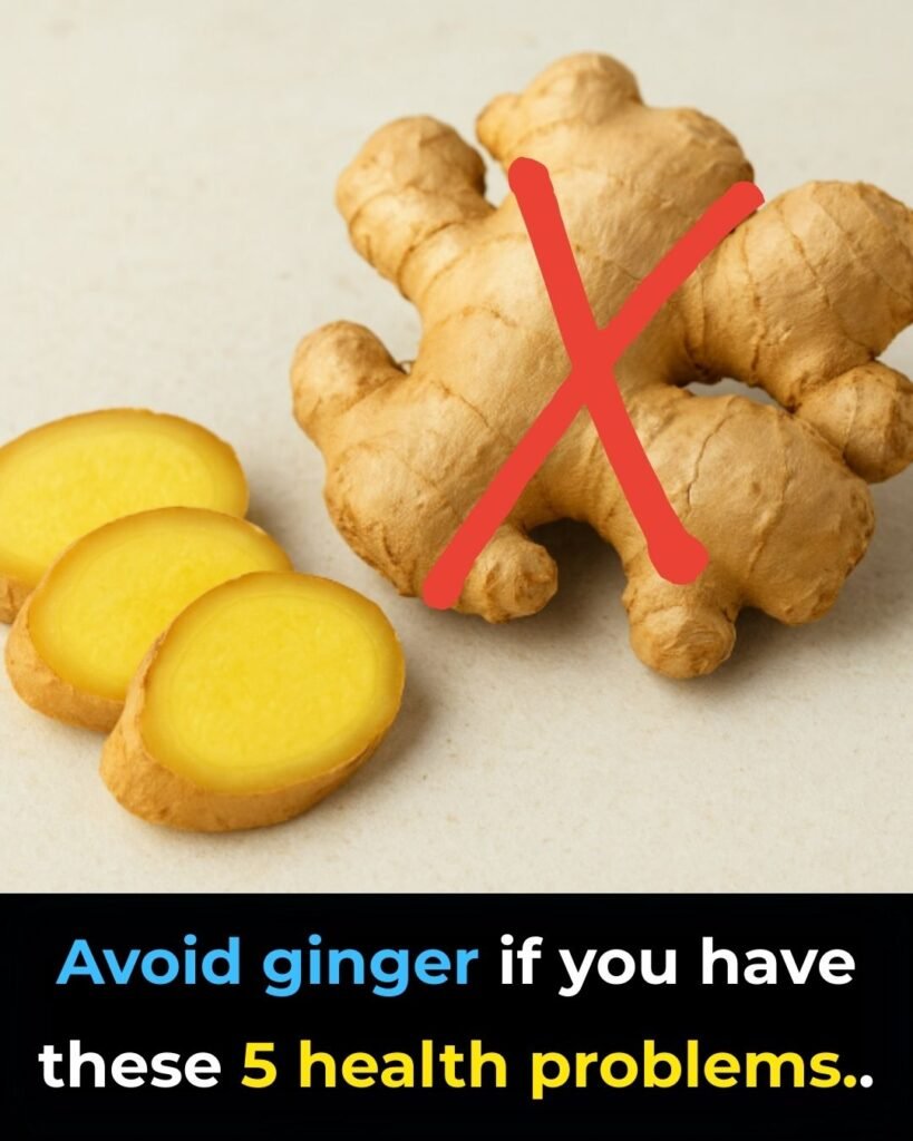 Avoid ginger if you have these 5 health problems..