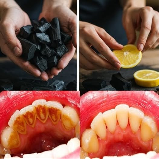 The Magic of Lemon Juice and Activated Charcoal: Natural DIY Solutions for Skin and Teeth
