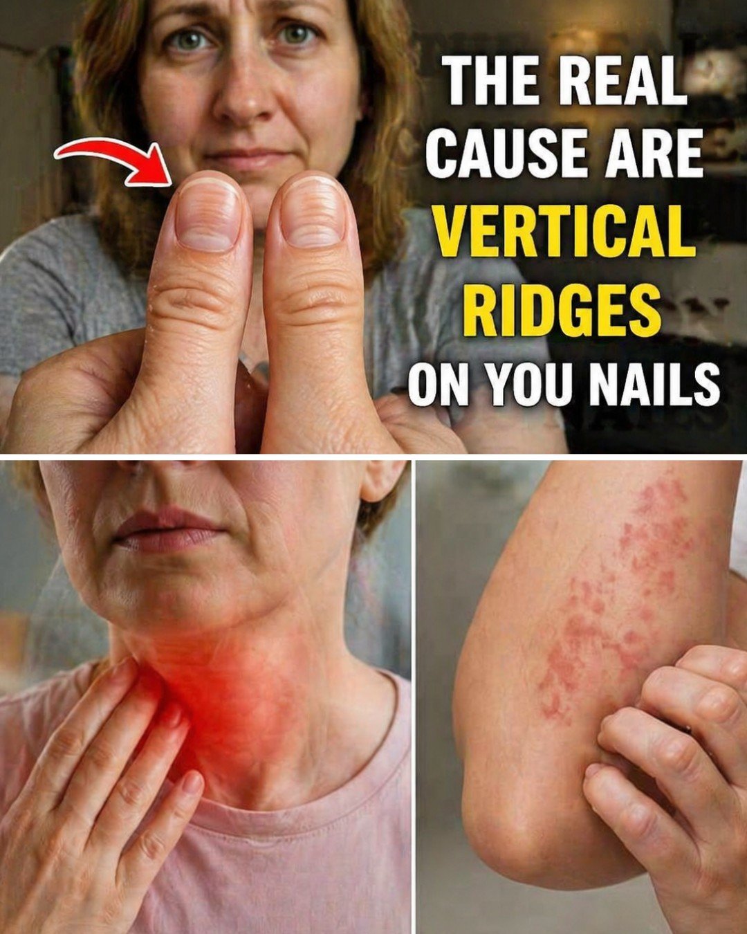 6 Causes Of Vertical Lines On Your Nails