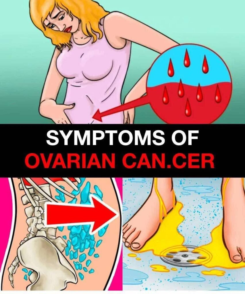 The link between ovarian and breast cancer