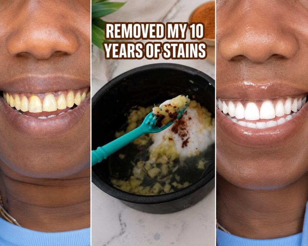 Banana Peel + Baking Soda Erase Yellow Teeth and Bad Breath Fast