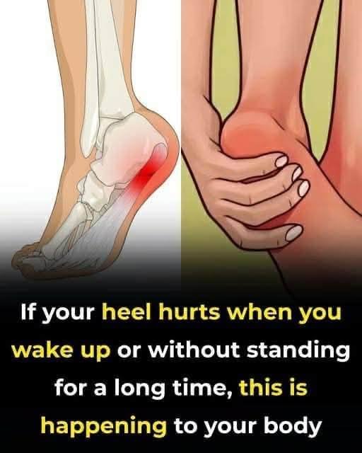 7 effective exercises to reduce heel pain and manage plantar fasciitis naturally