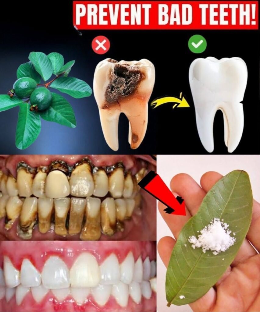 Guava Leaves for Oral Health: Benefits, Limits & Safe Ways to Use Them