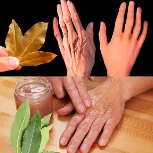 Unlock the Wonders of Bay Leaf for Vibrant Skin
