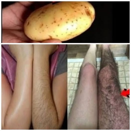 Say Goodbye to Unwanted Hair with Potato Magic!