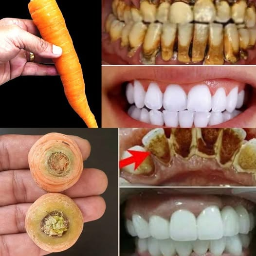 Brighten Your Smile Naturally with Carrots