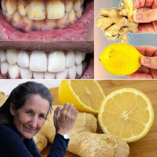In Just 2 Minutes: Turn Yellow Teeth Milky White with Lemon & Ginger