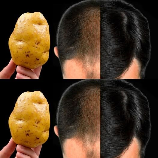 Hair Grows Like Crazy and Doesn’t Fall Out! The Most Powerful Remedy – POTATO!
