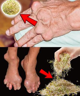 Alfalfa: A Gentle Green Ally for Kidney and Joint Comfort 🌿