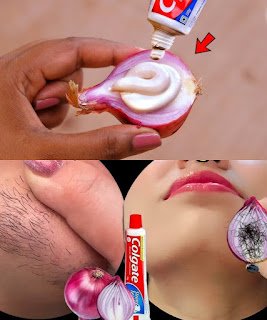 Toothpaste + Onion: The Surprising Natural Hair Removal Trick 🌿✨