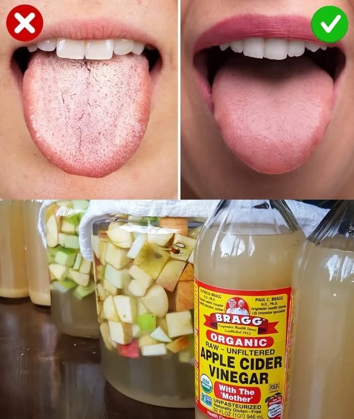 Apple Cider Vinegar & Oral Hygiene: What It Can and Can’t Do