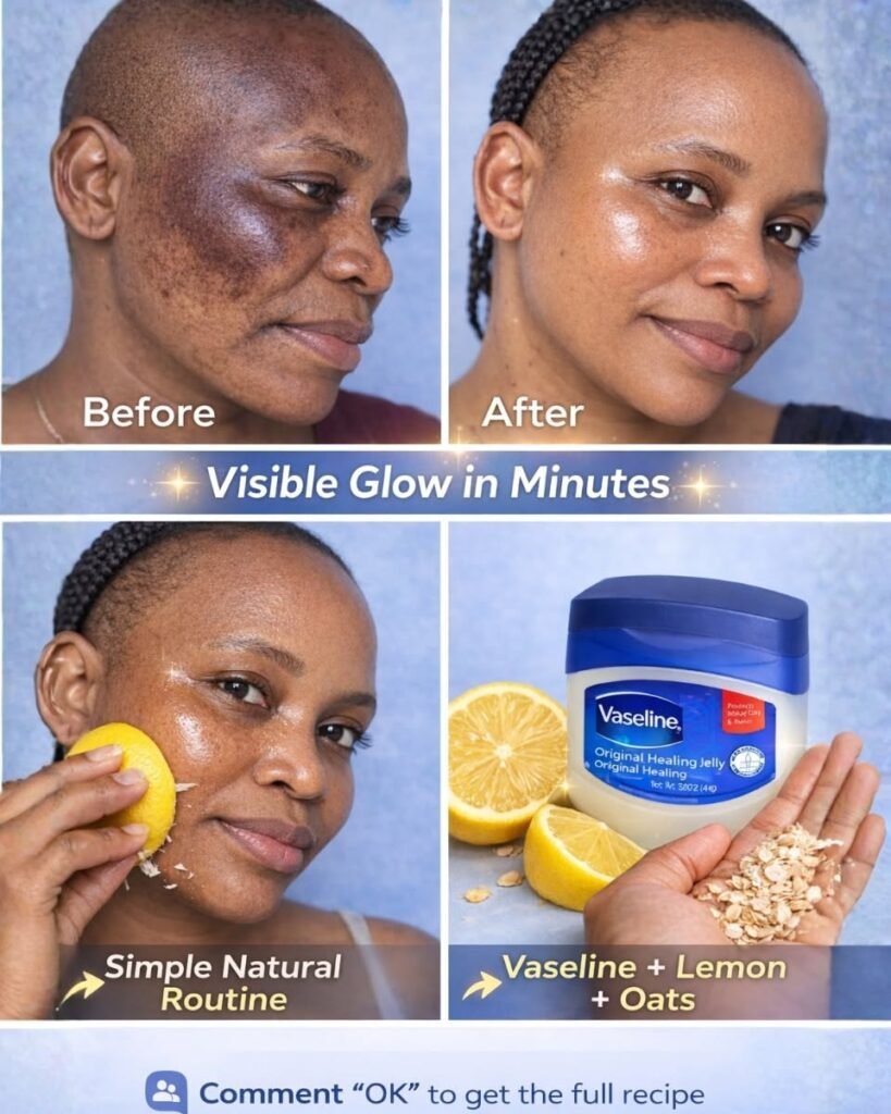 Can Lemon Juice Fade Acne Marks? Natural Support for Brighter, More Even-Looking Skin