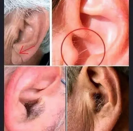 Why Hair Grows on Your Ears as You Age: The Science Behind This Common Change 👂