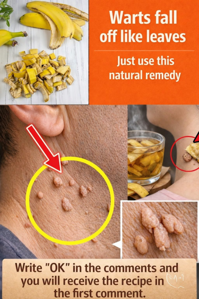 Banana Peel & Natural Ingredients for Wart Care: A Gentle, Traditional Approach