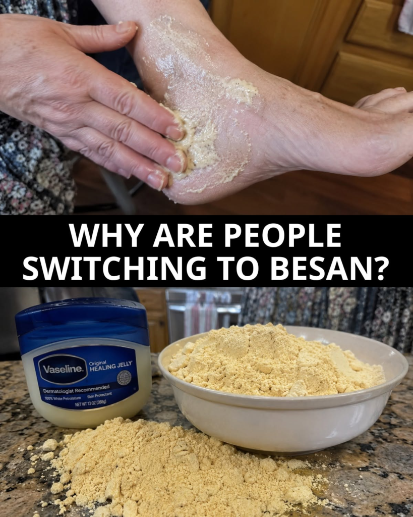 Besan and Vaseline Trigger a Faster Fix for Dry, Rough Skin