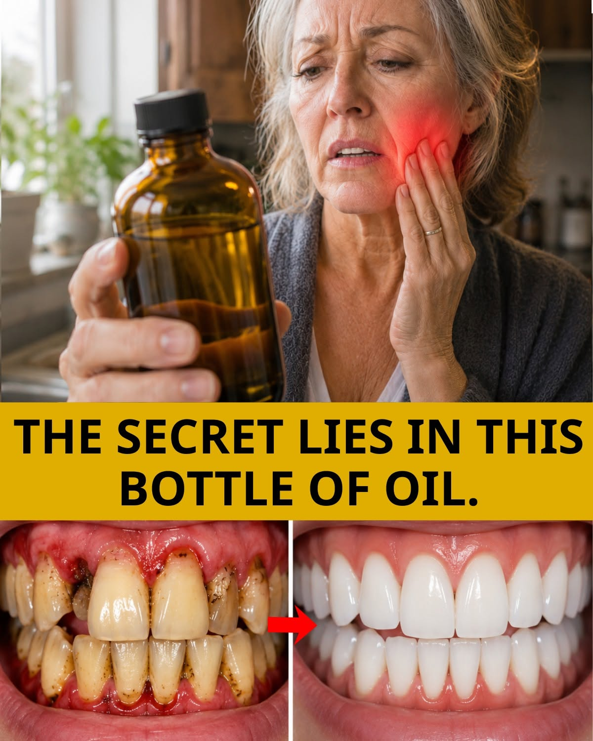 What Manuka Oil Triggers Inside Bleeding Gums