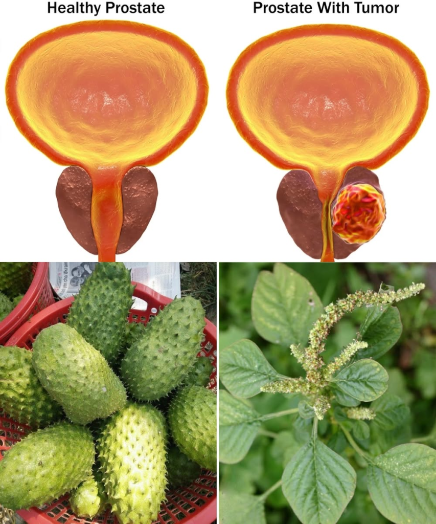No Man Should Die From Prostate Cancer: The Natural Remedy Every Man Should Know