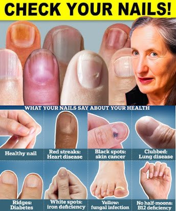9 Gentle Clues Your Nails Give About Your Health—and How to Support Them Naturally