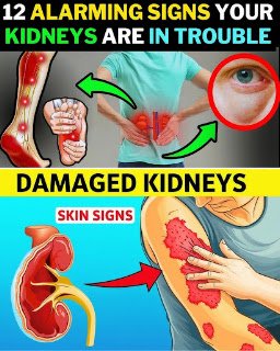 23 Subtle Signs Your Kidneys Might Be in Trouble (And You Probably Ignore Them)