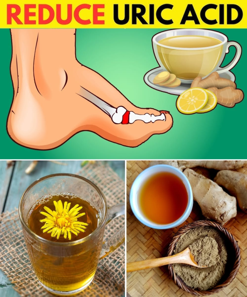 12 Herbal Teas That May Help Reduce Uric Acid and Ease Gout Naturally