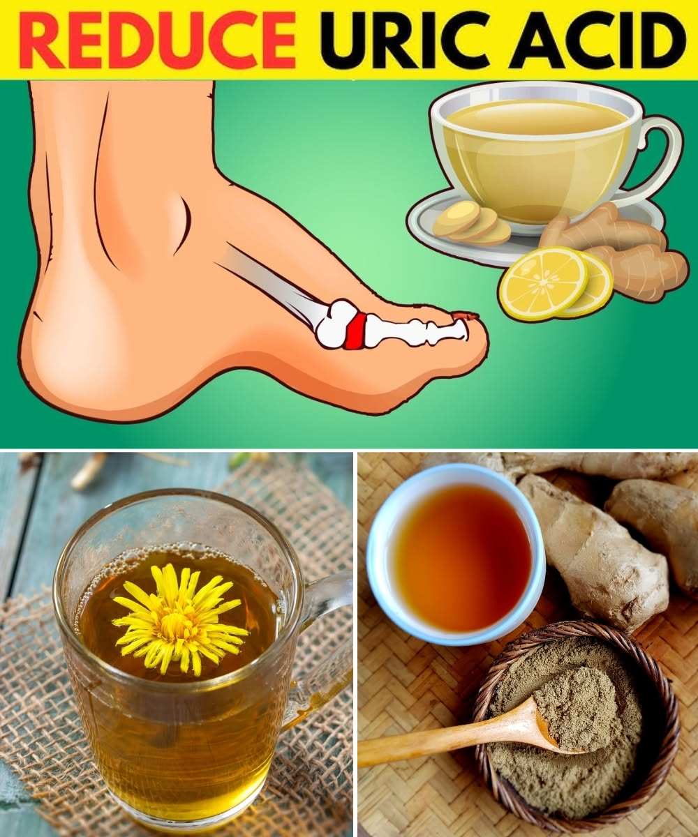 12 Herbal Teas That May Help Reduce Uric Acid and Ease Gout Naturally