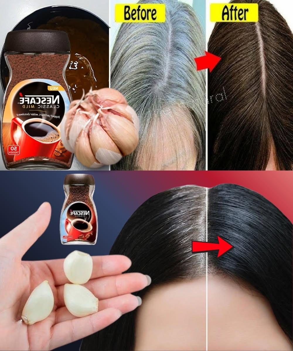 Natural Remedy for Grey Hair: Nescafé and Garlic Treatment