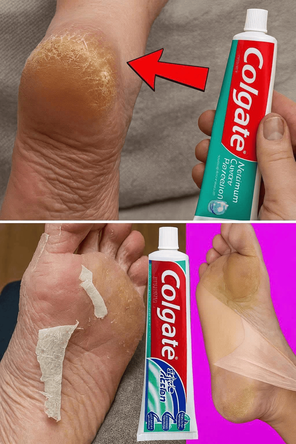 Unveil Colgate’s Surprising Secret for Softer Feet