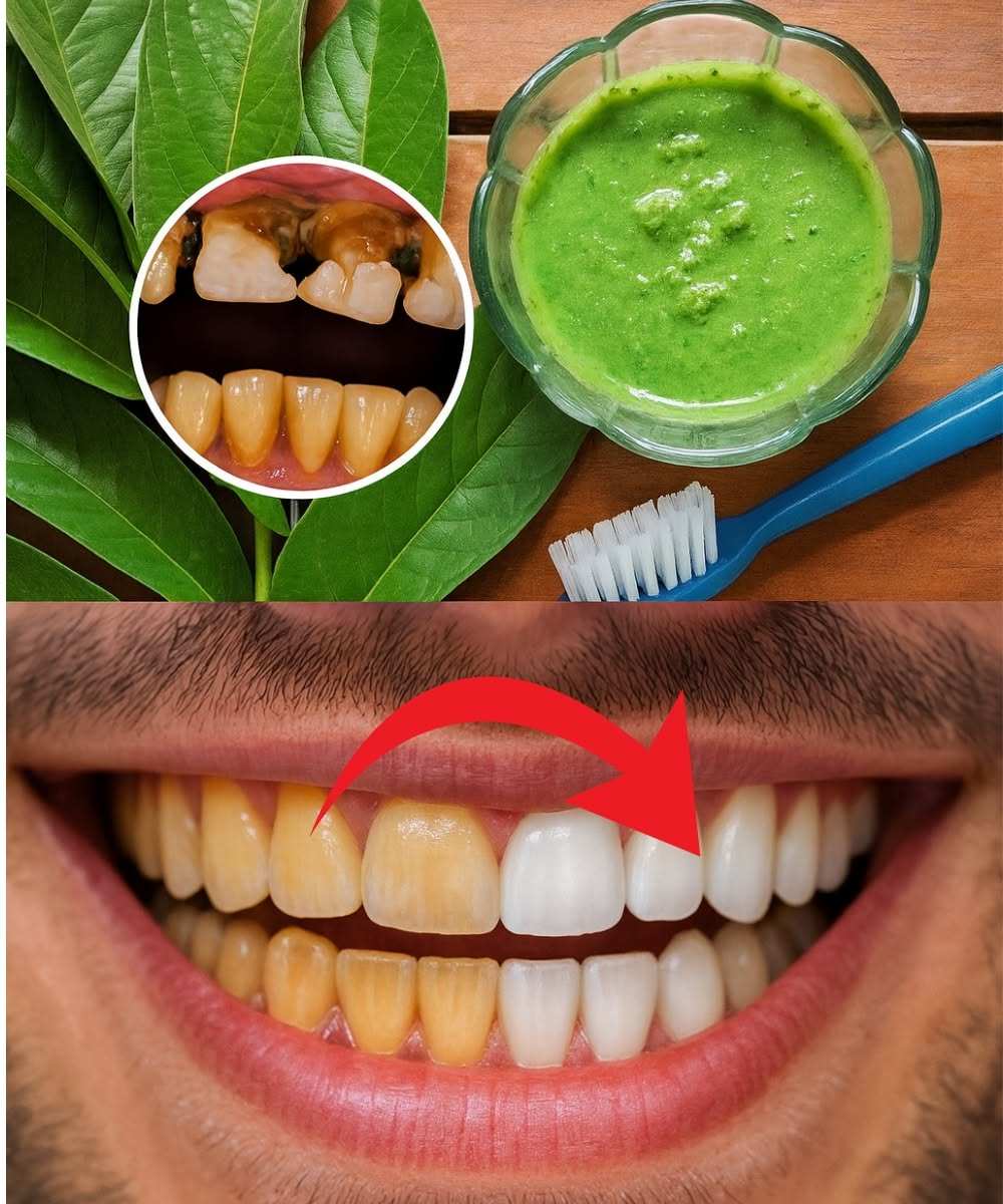 Grandma’s Shocking Secret to a Hollywood Smile: Guava Leaves Unveiled!