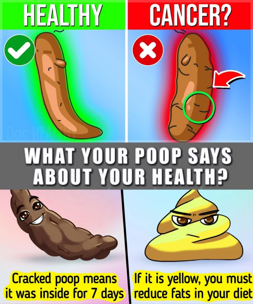 What Your Poop Says About Your Health: The Surprising Truth Behind Stool Color and Shape