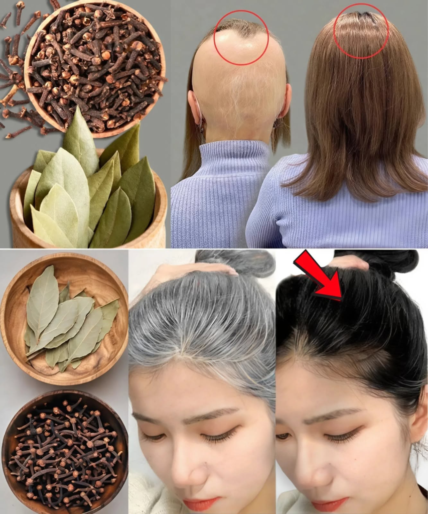 Regrow Thick, Dark Hair Like You Were 20 — Even After 50, Using Bay Leaf and Clove Magic!