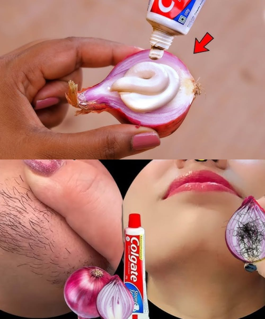 Toothpaste + Onion: The Surprising Natural Hair Removal Trick