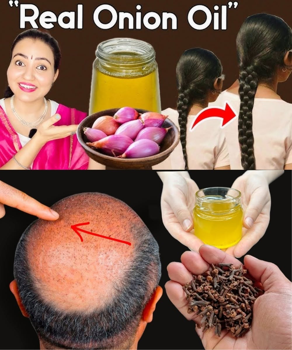 Clove & Onion Peel Hair Tonic: The Natural Secret for Stronger, Thicker Hair