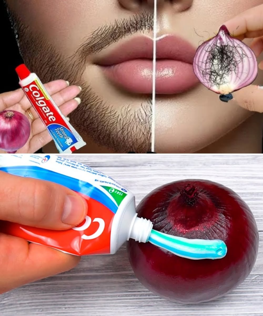 A Natural, Pain-Free Way to Reduce Unwanted Hair – Using Toothpaste and Onion?