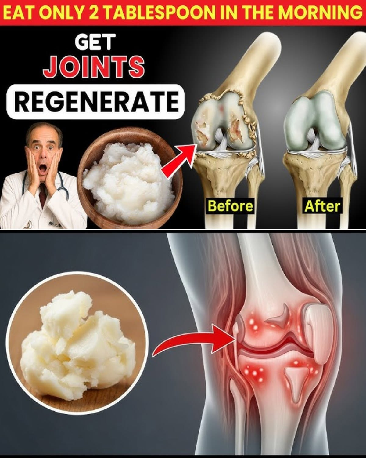 Eat These to Support Knee Cartilage Health Naturally (Gentle, Science-Backed Tips for 50+)