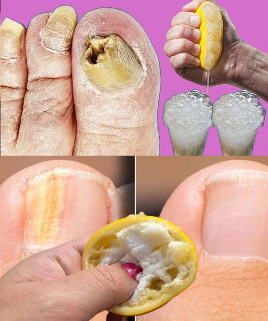 Lemon and Garlic for Toenail Care: The Natural Solution You Need to Try
