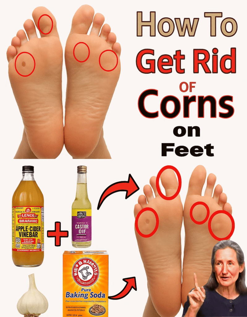 Say Goodbye to Corns and Calluses: 14 Proven Home Remedies That Really Work!