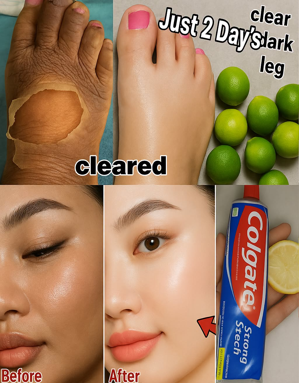 DERMATOLOGIST WARNING: Zesty Fix—Banish Unwanted Hair with Lemon and Toothpaste