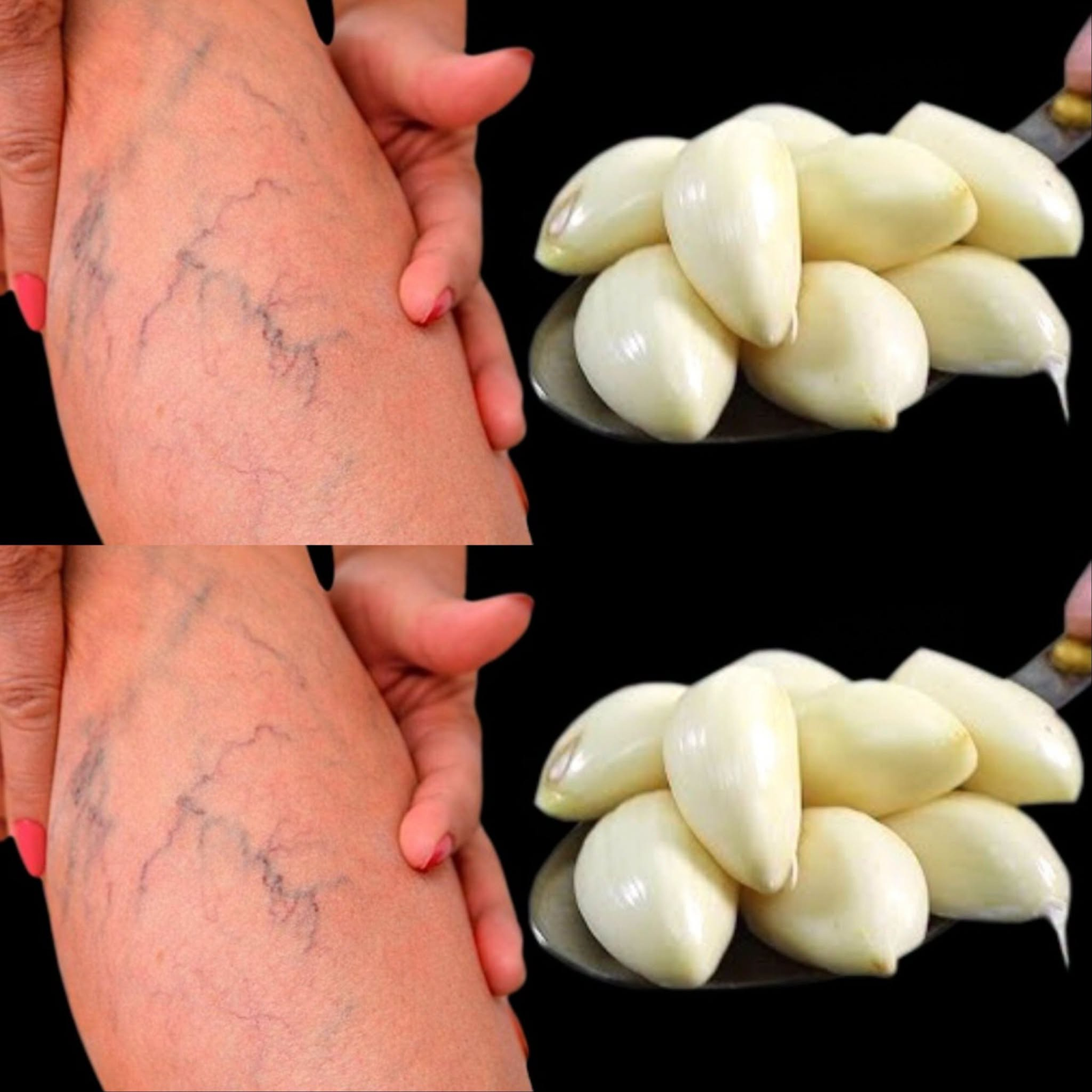 Leg pain, rheumatism, varicose veins, arthritis, headache, joint pain.