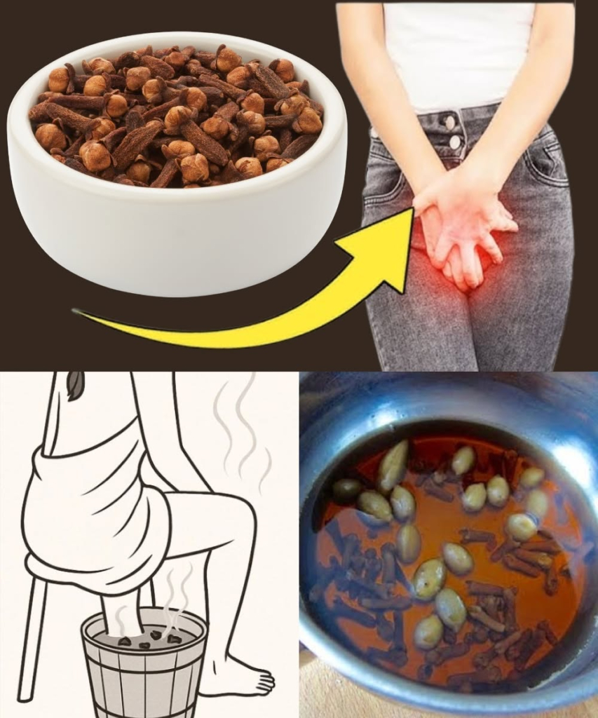 Unlocking the Natural Power of Cloves: Simple Home Remedies for Better Health