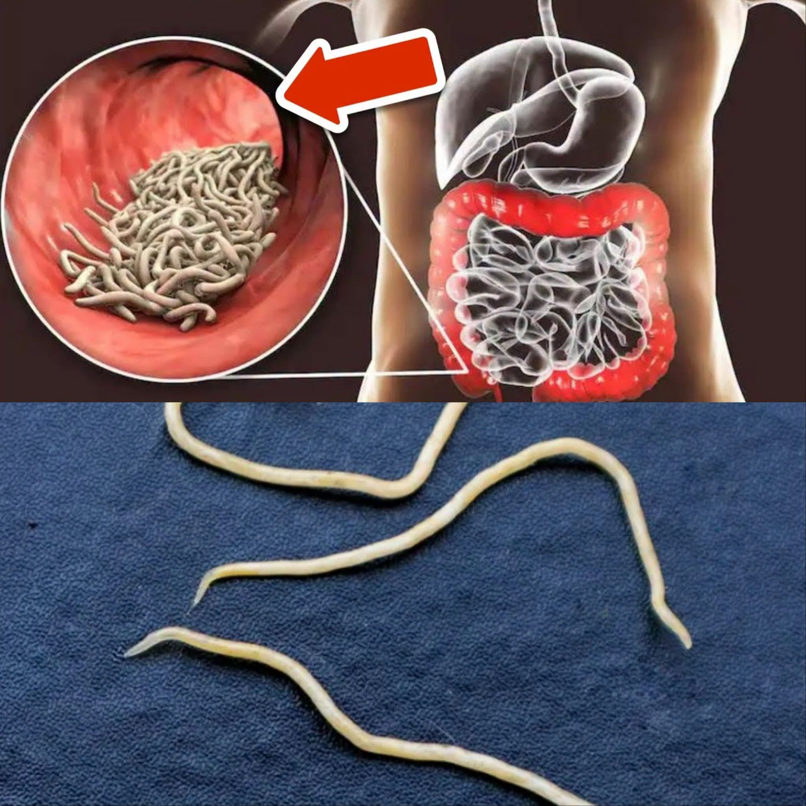 Only 2 Spoons! The Old-Fashioned Seed & Spice Mix for Gut Health