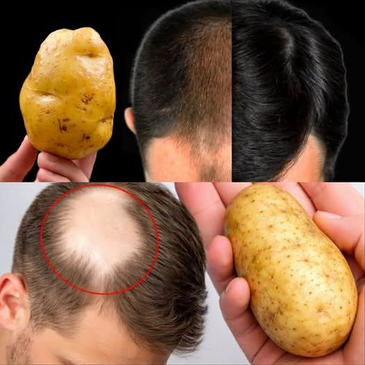 Hair grows like crazy and doesn’t fall out! This is the most powerful tool! Strongest Ingredient