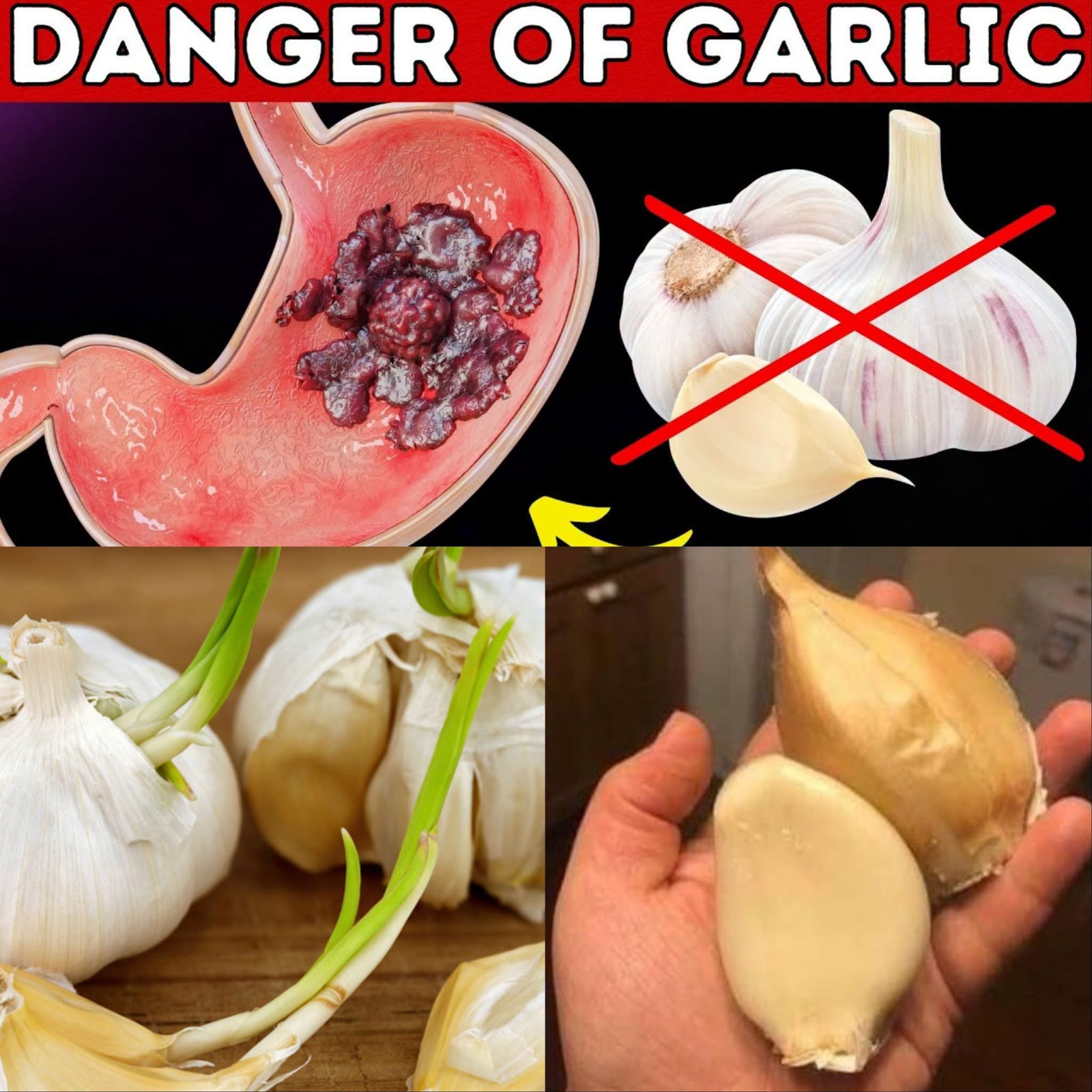 Take Garlic, But Avoid This Common Mistake! | 95% of People Are Unaware