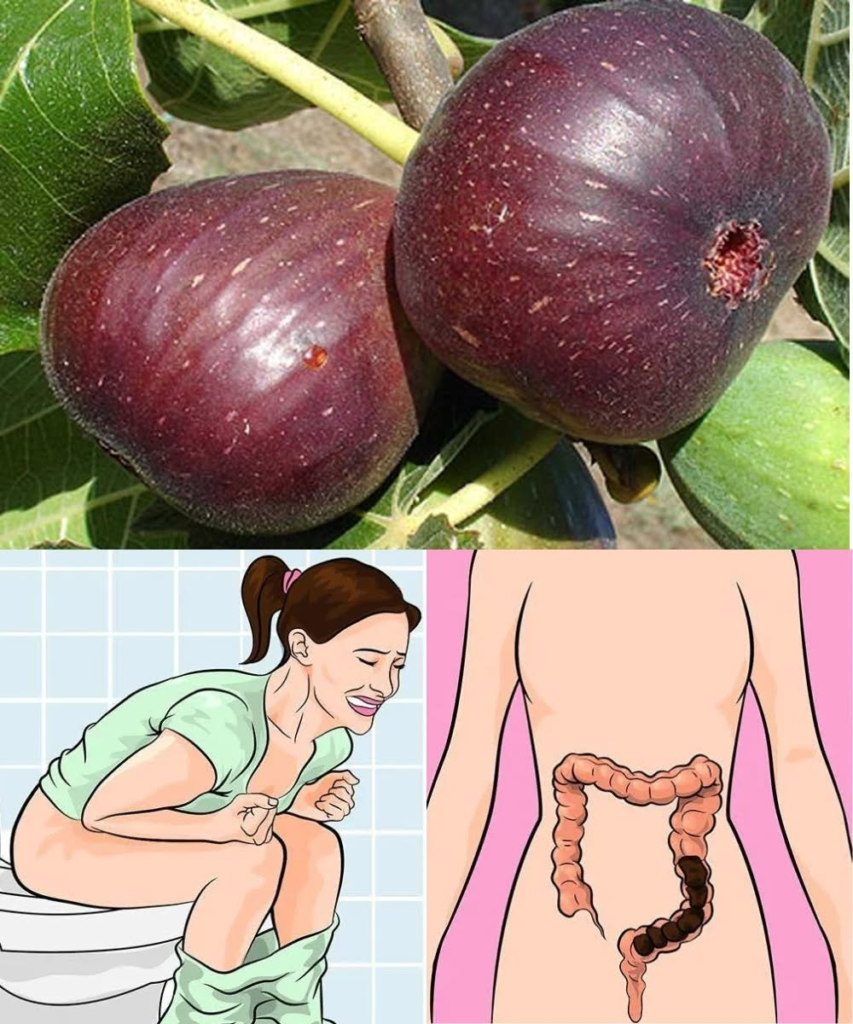 7 Natural Remedies to Beat Constipation Fast — The Fig Trick You Shouldn’t Ignore