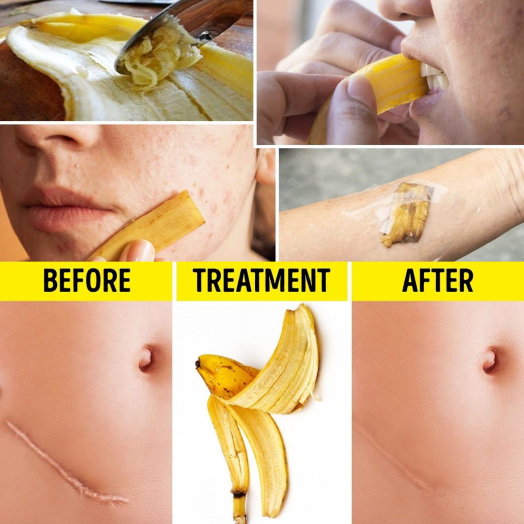 9 Unusual Uses For Banana Peels