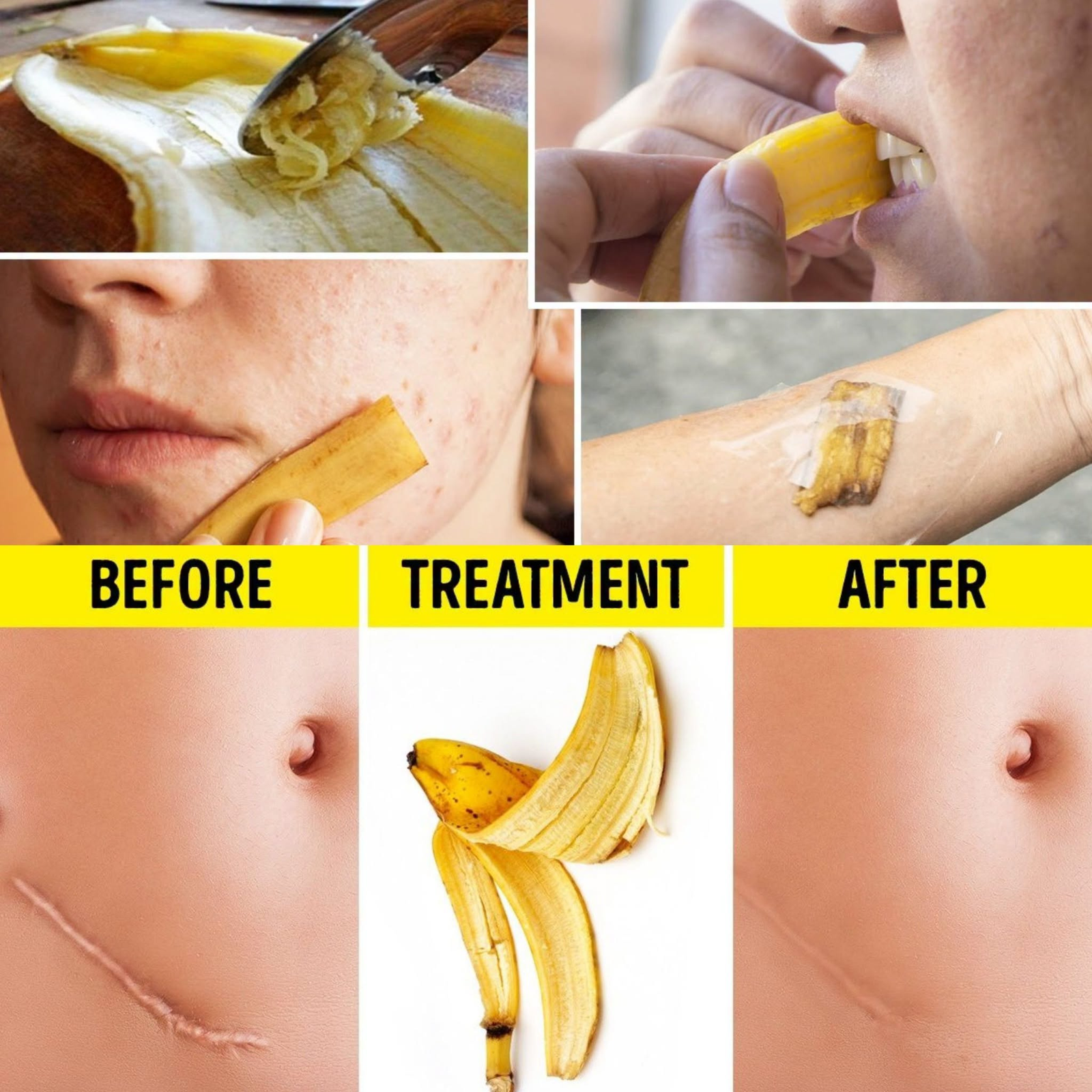 9 Unusual Uses For Banana Peels